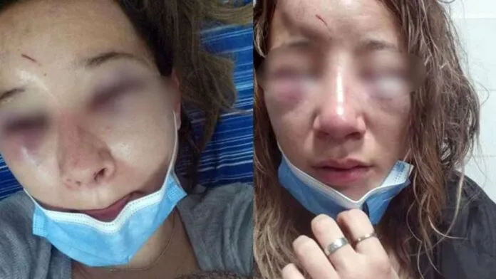 Golpean a mujer a la salida de un boliche